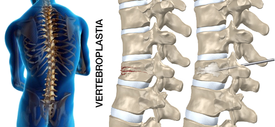 photo vertebro_zpsbf4b8683.png