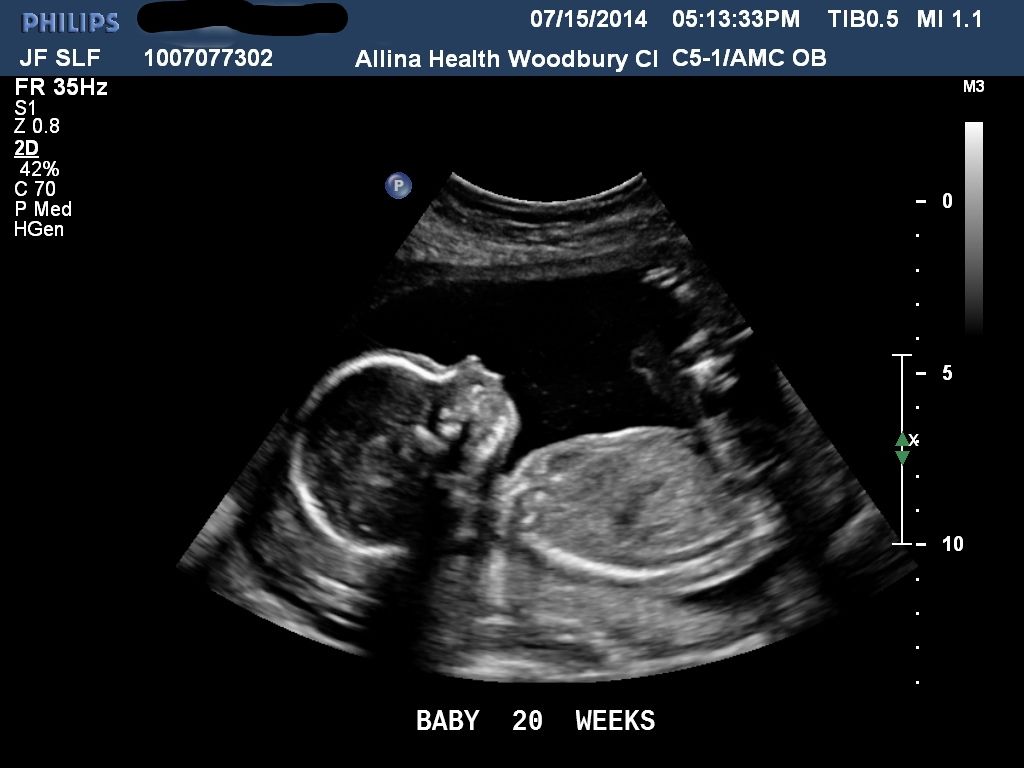 photo 7c41a36f-19e4-4879-80e8-dccff67ec5fa_zps78471f1b.jpg