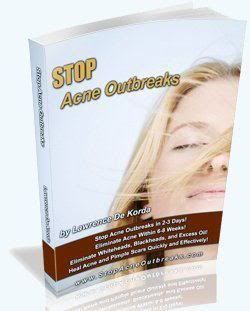 how to get rid of acne (c) ancetoday how to get rid of hives
